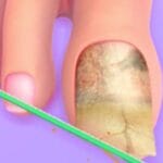 Image of a close-up animated toe with a large, discolored toenail being filed with a green nail file, set against a purple background.